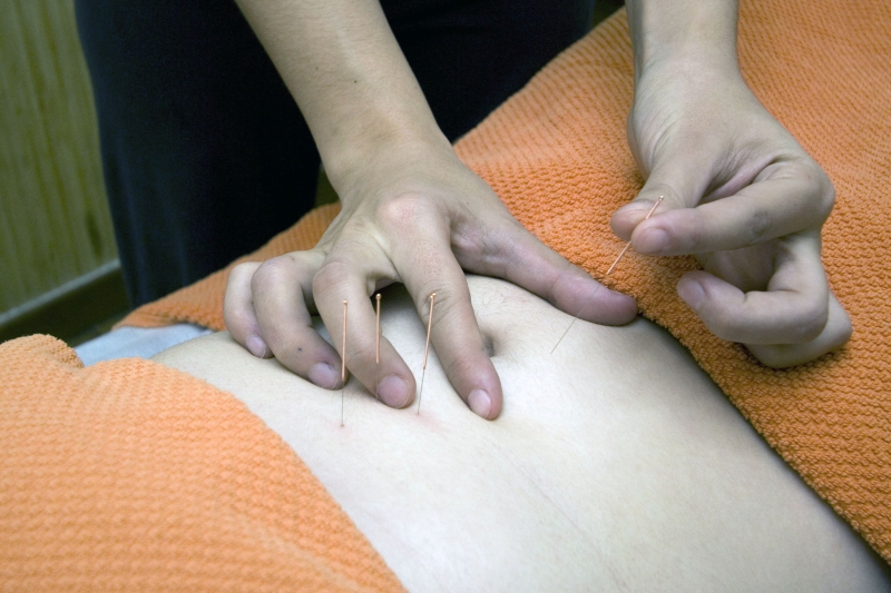 osteopathe-GOURDON-min_acupuncture-4175625